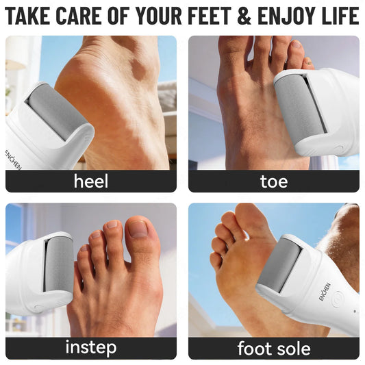 Enchen Electric Foot Callus Remover Rechargeable Ipx6 Waterproof 2 Speeds USB Charging 1 Sanding Head